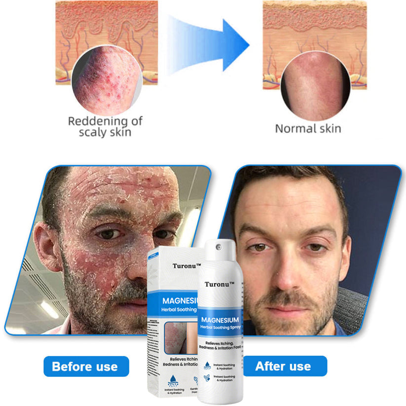 🔥🔥【HOT】Magnesium Herbal Soothing Spray🌿