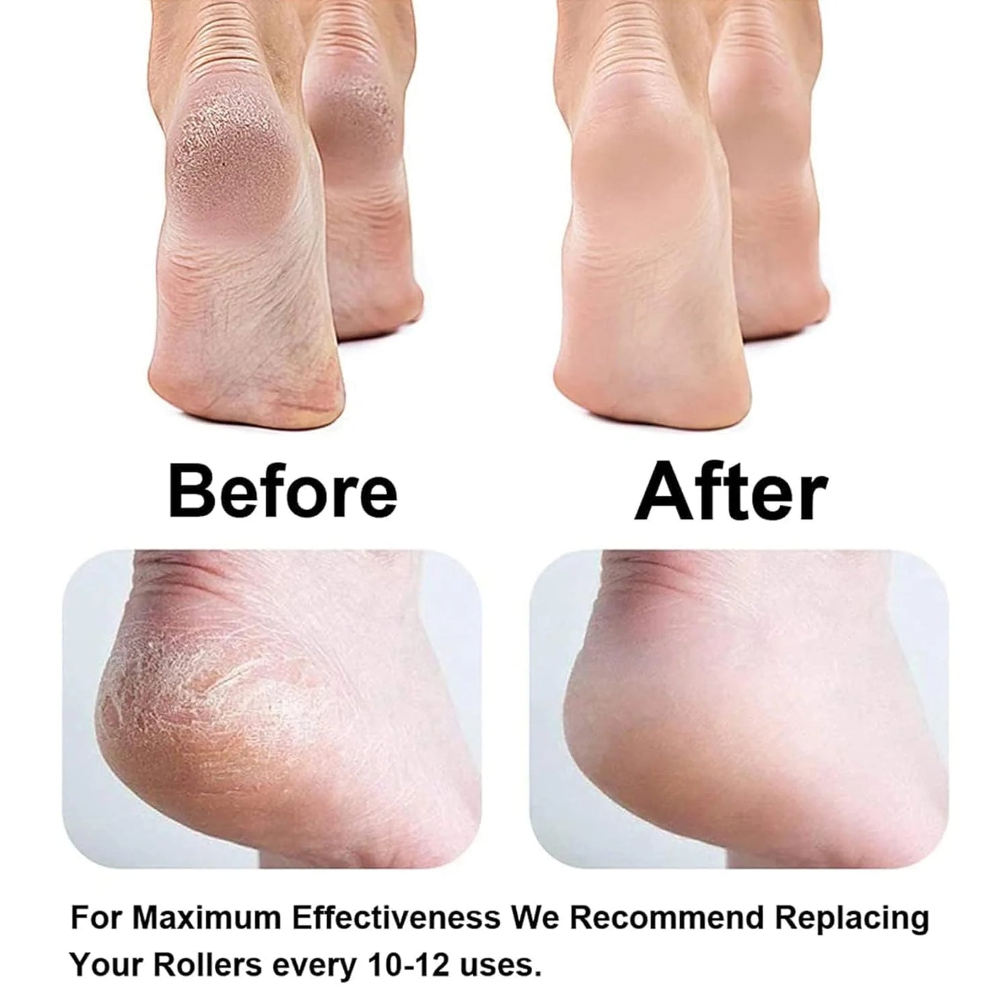 🏃FLASH SALE! Electric Callus Remover - 55% OFF Today! ✨