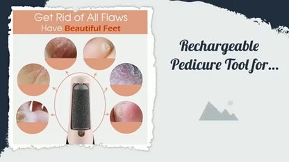 🏃FLASH SALE! Electric Callus Remover - 55% OFF Today! ✨
