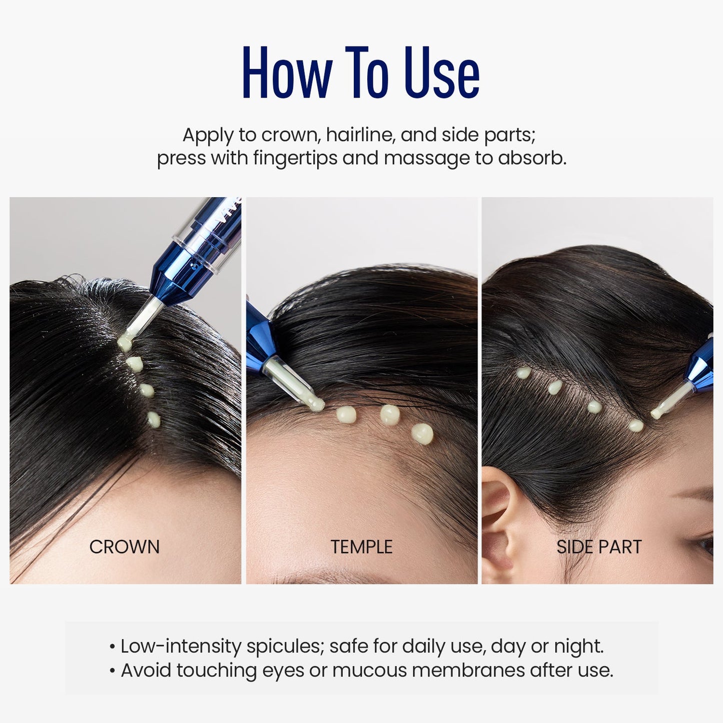 ViveLab Spioxyl™ Scalp Serum 400 – 220K Micro-Spicules for Thicker, Fuller Hair | Korea’s Best-Selling Dermatologist-Recommended K-Beauty Scalp Serum (0.5 fl oz)