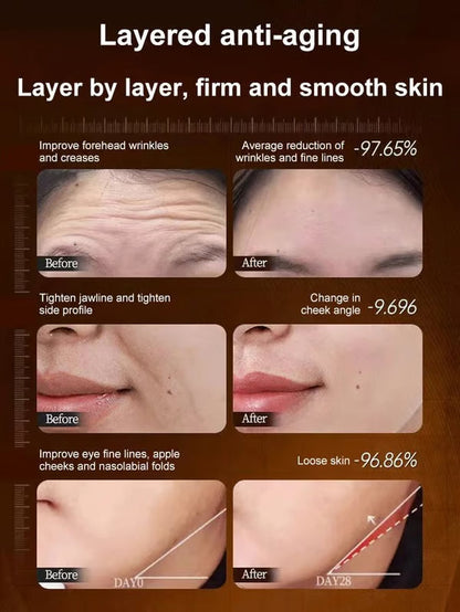 🔥BUY 1 GET 1 FREE🔥【One touch to remove wrinkles】Micro-molecular collagen anti-wrinkle lotion