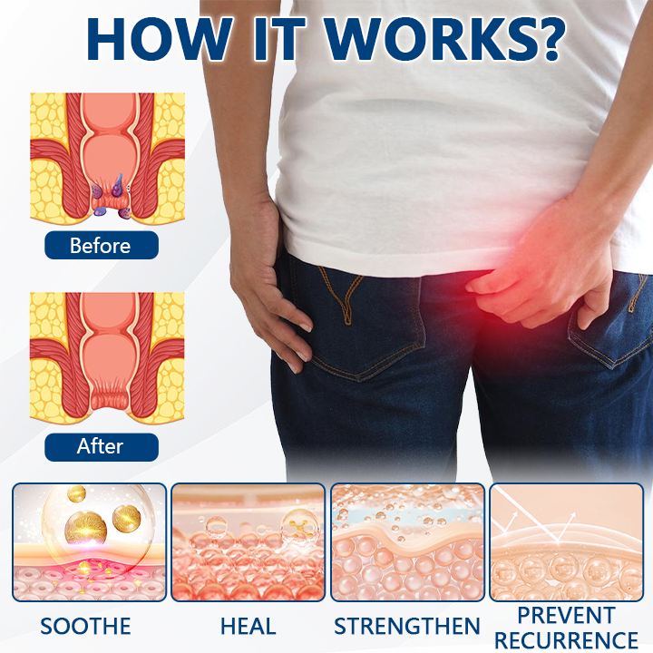 🔥SKAVIX™ HemoEase Herbal Spray – Say Goodbye to Burning, Itching & Discomfort Naturally 🌿