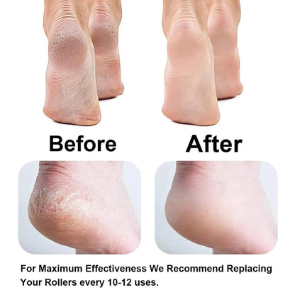 🏃FLASH SALE! Electric Callus Remover - 55% OFF Today! ✨