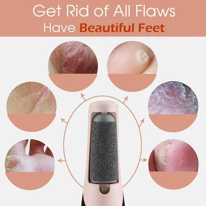 🏃FLASH SALE! Electric Callus Remover - 55% OFF Today! ✨