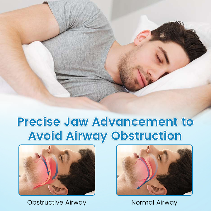 LAST DAY SALE 60% OFF⏰PerfectSleep Solution- Anti-Snoring & Anti-Grinding Teeth Protector